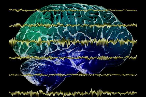 actividad-cerebral