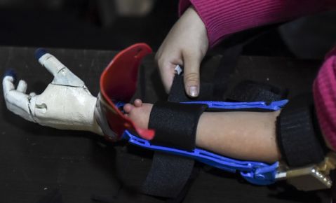 Colombian Shaio Valeria Novas, 6, tries her 3D printed prosthesis with a superhero “Wonder Woman” design, in Bogota, Colombia on June 12, 2017.  Fabrilab is a non-profit organization which develops free personalized prostheses with superhero designs, for disadvantaged disabled children or youngsters suffering from rheumatism. / AFP / RAUL ARBOLEDA / TO GO WITH AFP STORY by